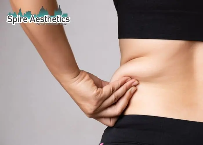 Image of woman pinching fat on their hips Wellingborough. Fat Freezing treatment