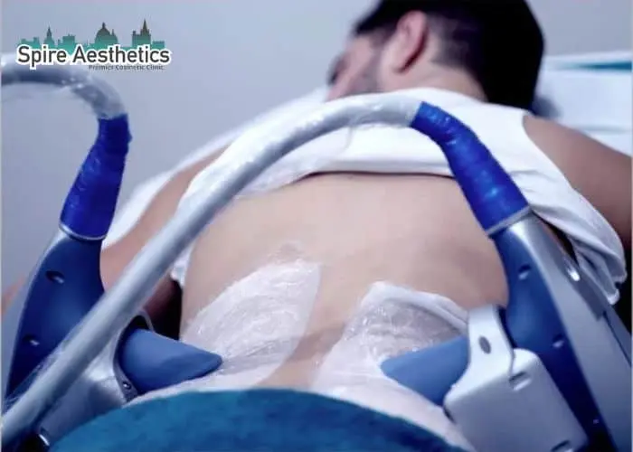 Man having fat freezing treatment done on love handles before a competitions Wellingborough to create a sculpted look.