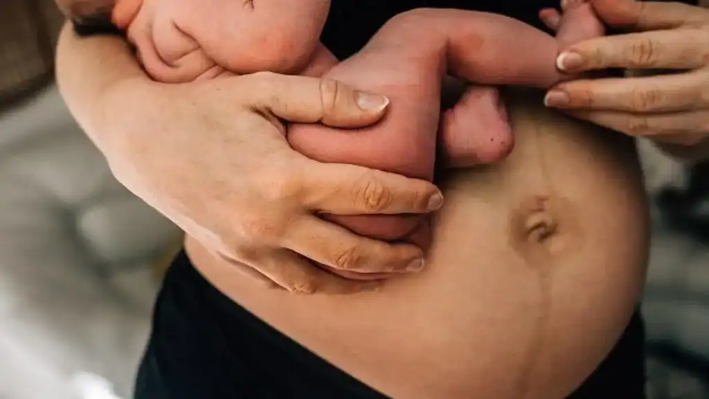 Why Is My Stomach Still Big After Pregnancy Wellingborough?